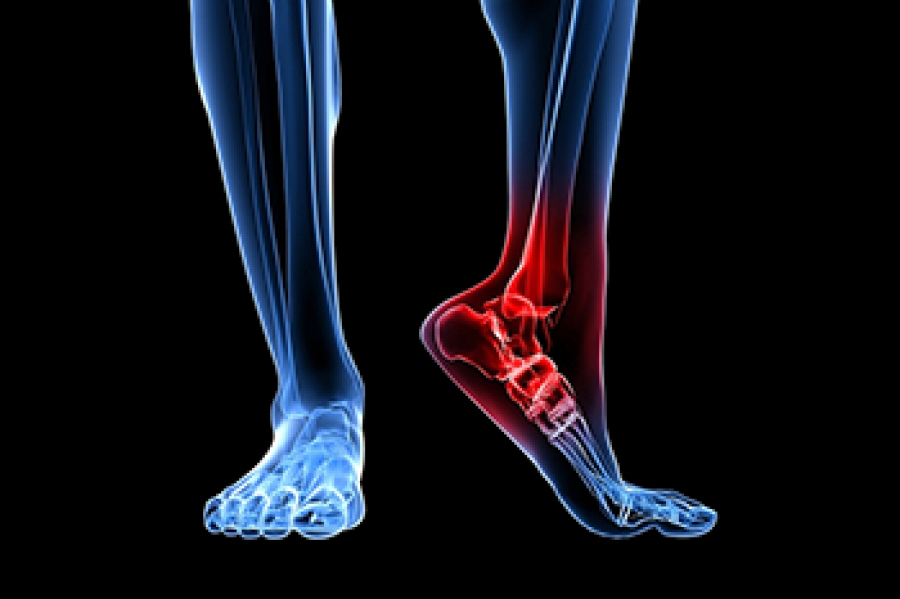 Causes Of Heel Pain